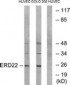 KDELR2 Antibody (aa81-130)